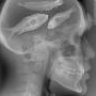 Fish Brain