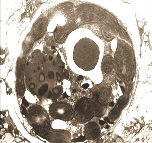 zooxanthellae.jpg